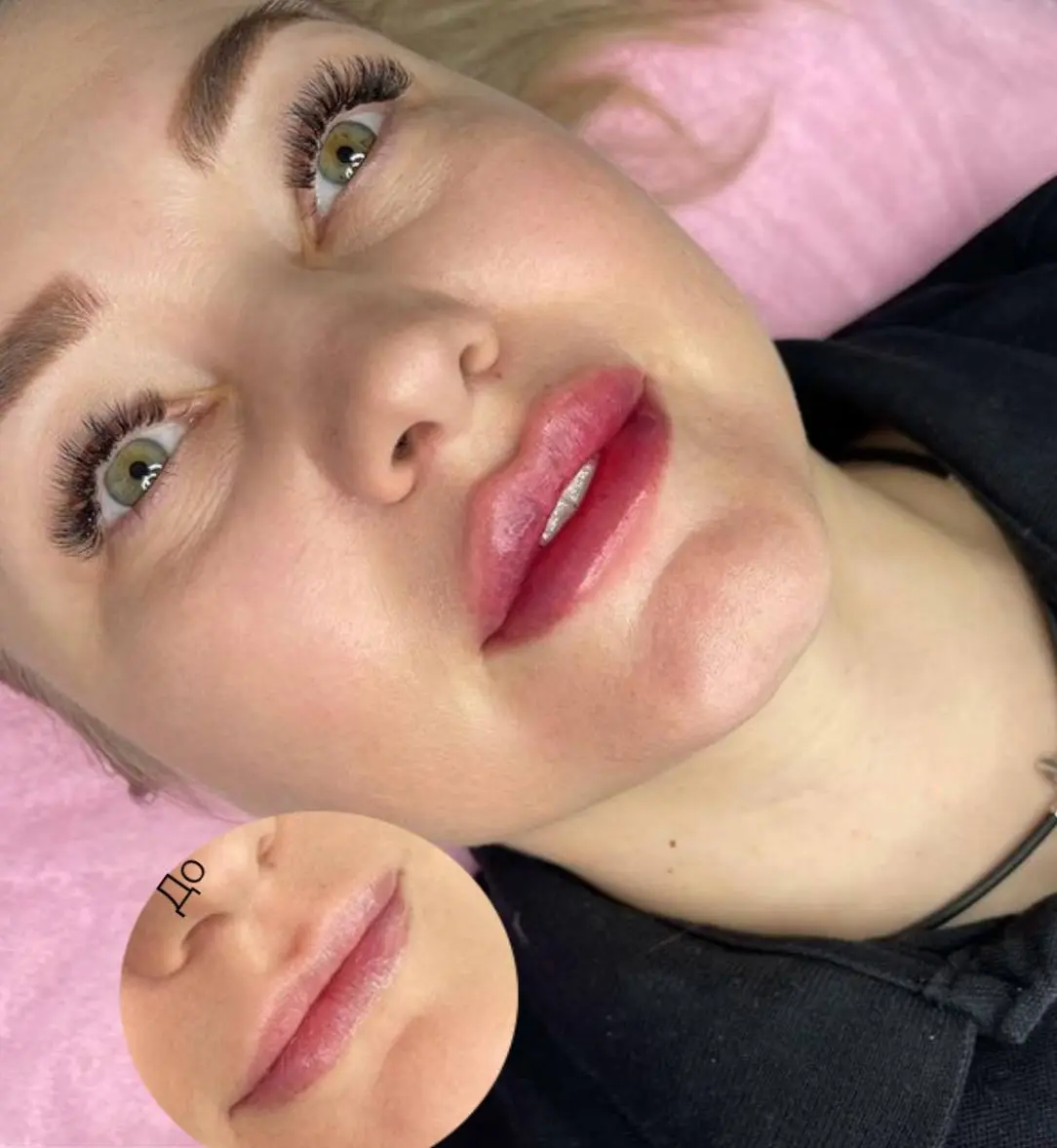 Наш красивый и сочный 1,1ml
Запись 🗓
📞Тел: 89179772607
What’sApp/ telegram
С любовью ваш косметолог ❤️
#мезосамара #косметолог #нити #косметологсамара #красота #губы #контурнаяпластика #контурнаяпласт... | Сетка — социальная сеть от hh.ru