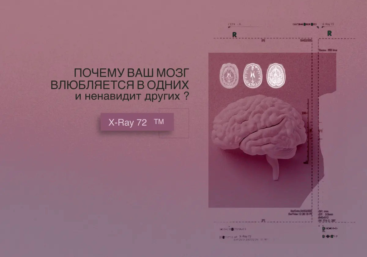 Почему ваш мозг влюбляется в одних  и ненавидит других ? | Сетка — социальная сеть от hh.ru