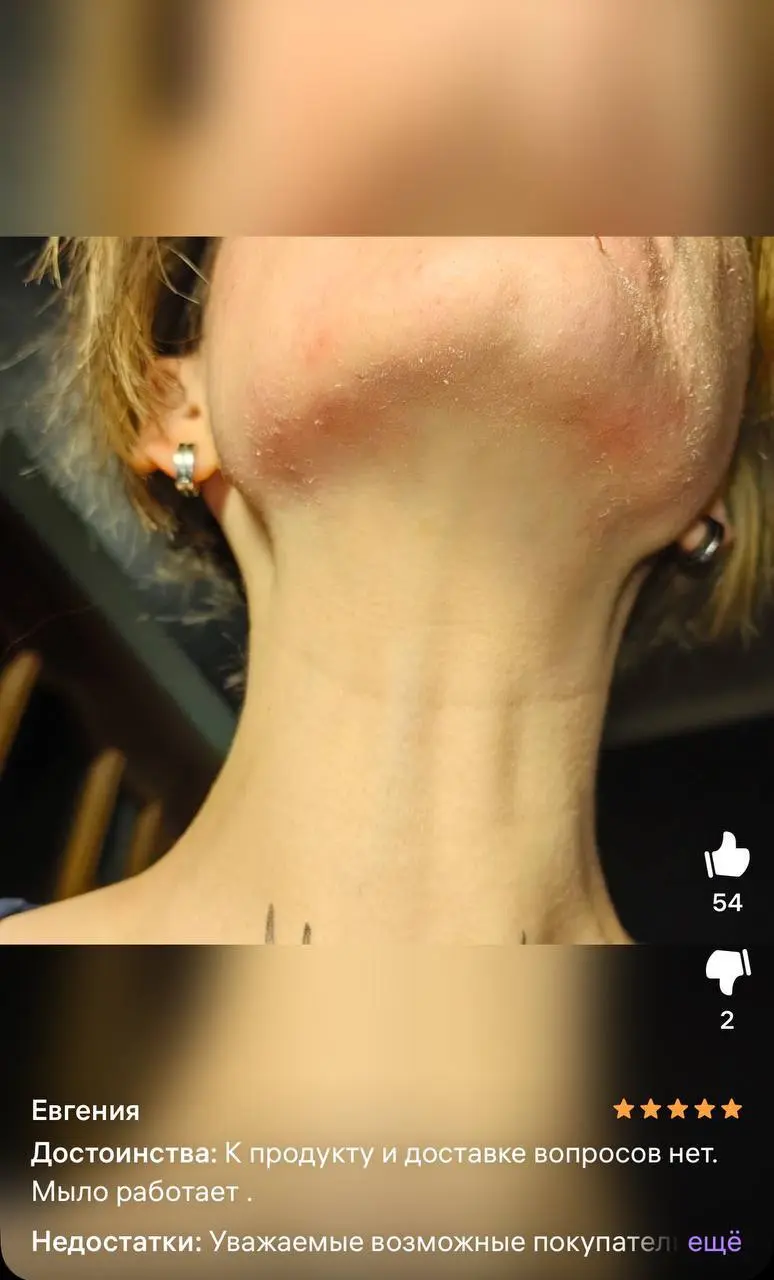 ⚠️ Ребята, вы видели, какую «уникальную» новинку выкатили на WB? Новое мыло 🧼с бензоила пероксидом 2 | Сетка — социальная сеть от hh.ru