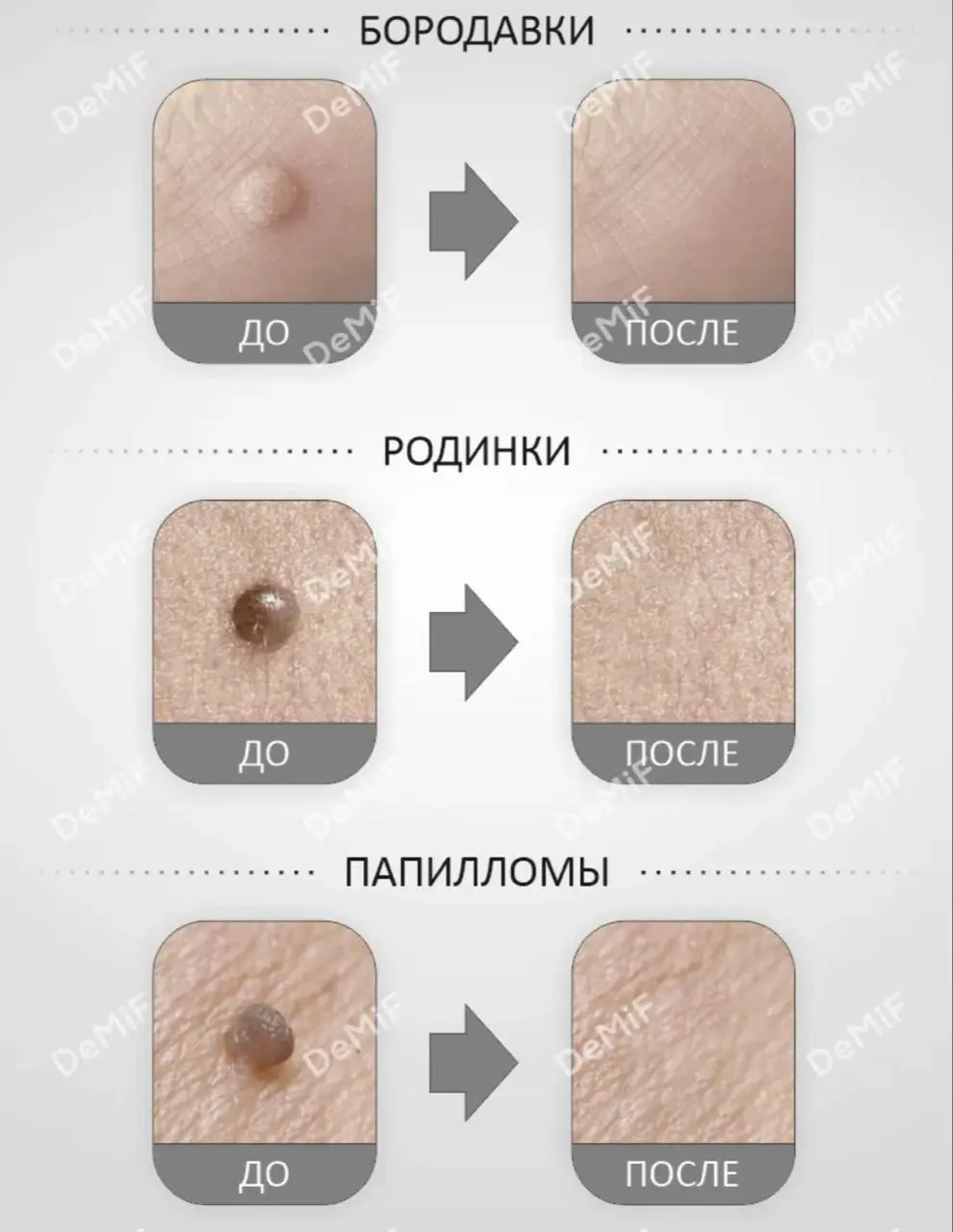 Аппарат Работает по технологии ионной карбонизации, обеспечивая точное и безопасное воздействие на кожу | Сетка — социальная сеть от hh.ru