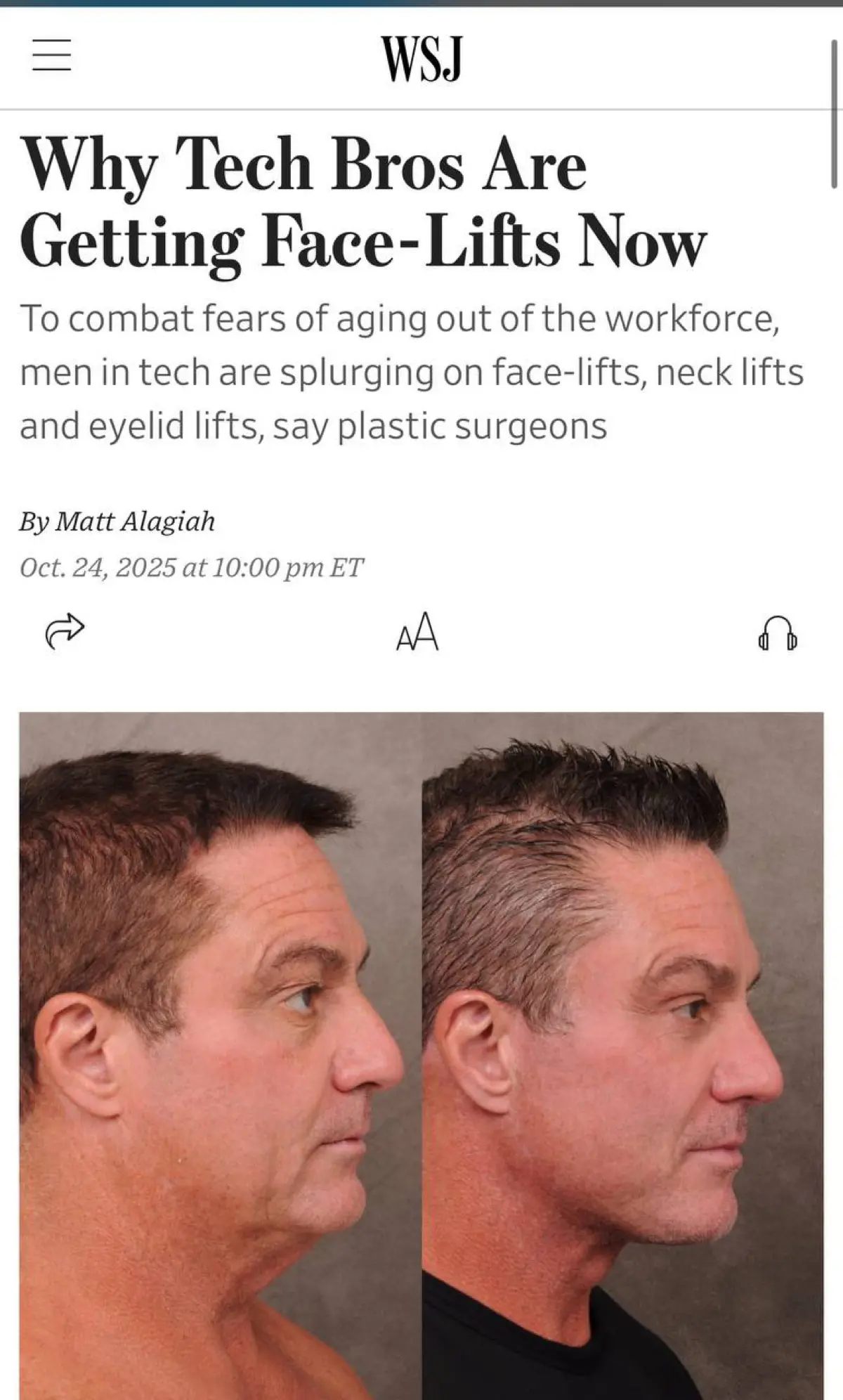 Сегодня наткнулась на интересную новость - https://www.wsj.com/style/fashion/why-tech-bros-are-getting-face-lifts-now-94278bb7 и решила почитать поподробнее | Сетка — социальная сеть от hh.ru