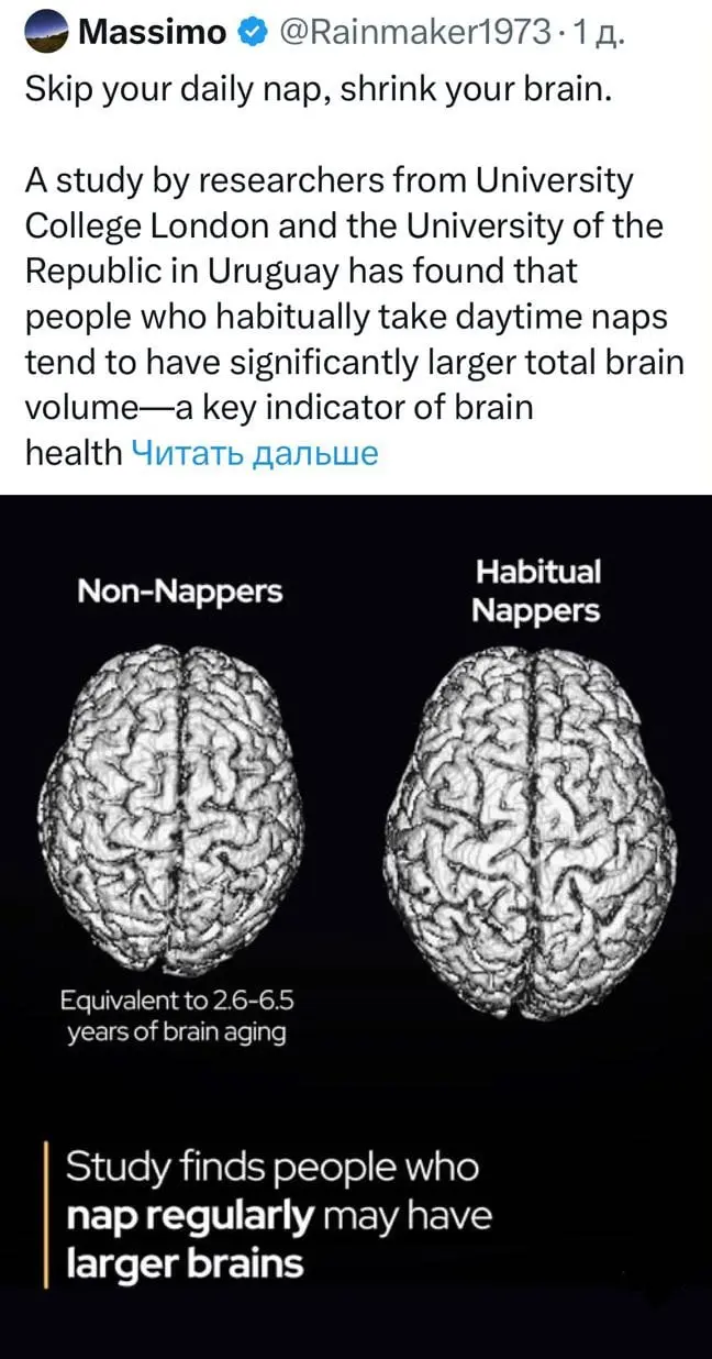 🧠 Регулярный дневной сон замедляет старение мозга и повышает продуктивность — учёные | Сетка — социальная сеть от hh.ru