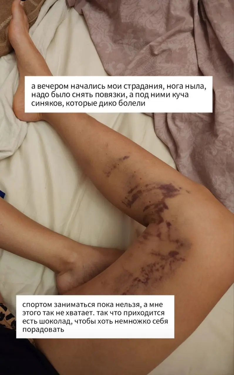История одной операции в картинках | Сетка — социальная сеть от hh.ru