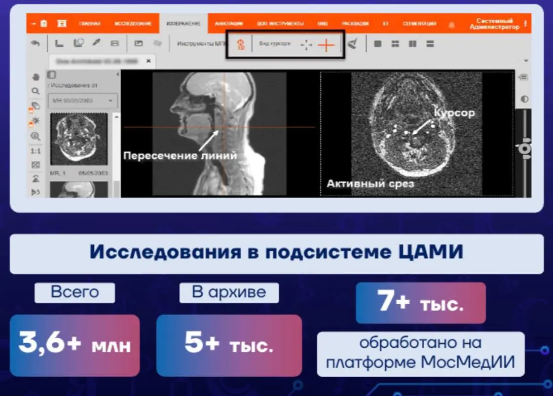 #итогигода
Продолжаем - ЦАМИ.
▶️ Более 3️⃣0️⃣0️⃣0️⃣ активных пользователей единой радиологической информационной системы | Сетка — социальная сеть от hh.ru