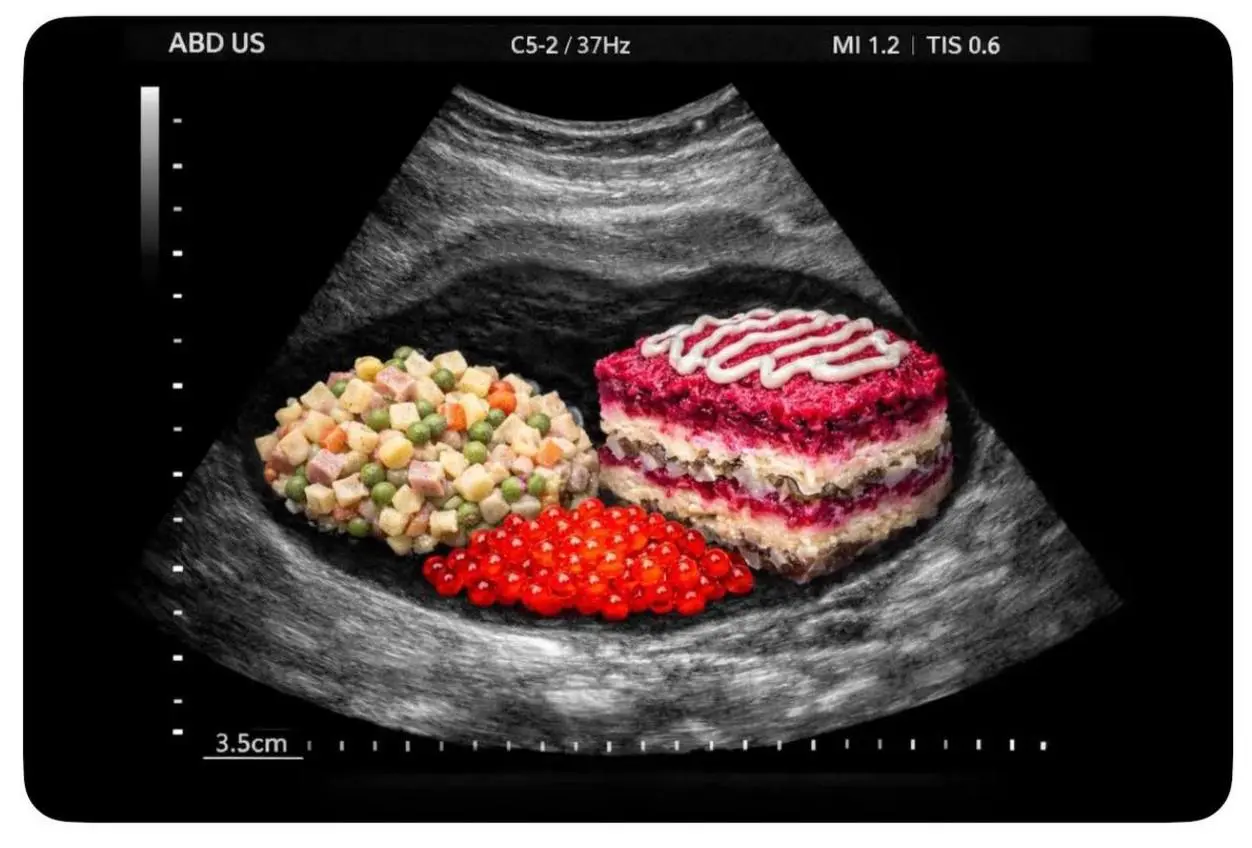 #ny | Сетка — социальная сеть от hh.ru