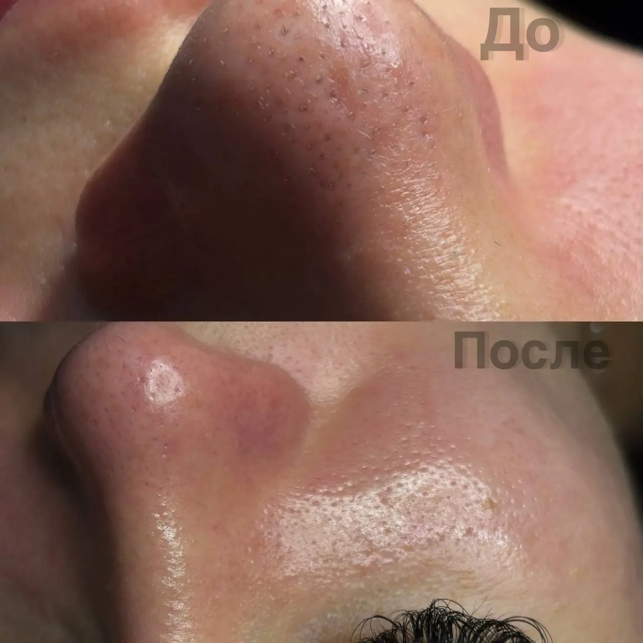 Тел: 89179772607
What’sApp/ telegram
С любовью ваш косметолог ❤️
#мезосамара #косметолог #нити #косметологсамара #красота #губы #контурнаяпластика #контурнаяпластикагуб #иньекции #чистка #самара #дево... | Сетка — социальная сеть от hh.ru