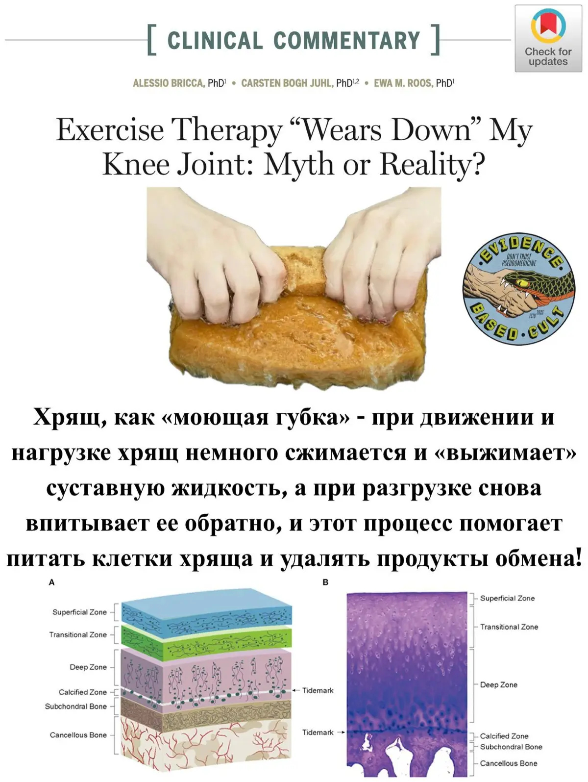 Изнашиваются ли суставы от физической нагрузки? | Сетка — социальная сеть от hh.ru