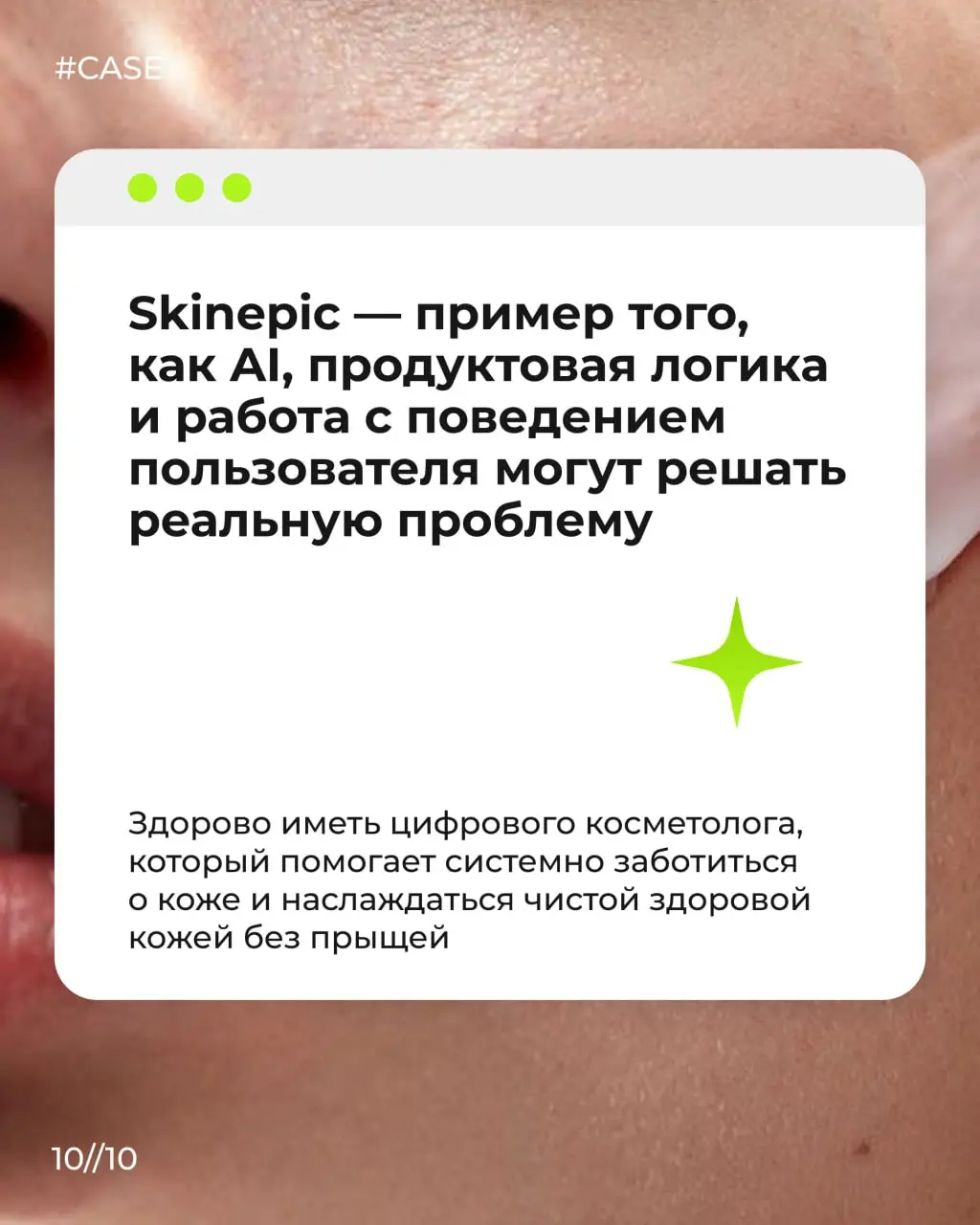 Как превратить сложную медицинско-косметологическую тему в понятный и вовлекающий продукт? 😀
В этом кейсе показываем, как мы вместе с компанией «Аванта» создали Skinepic — мобильное приложение с AI-ан... | Сетка — социальная сеть от hh.ru