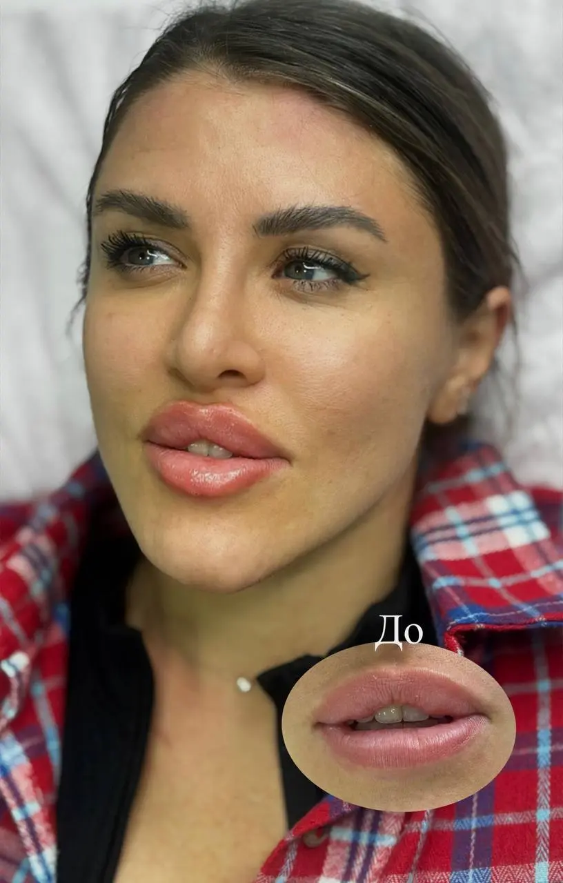 Мои красотки 1,1ml💋 | Сетка — социальная сеть от hh.ru