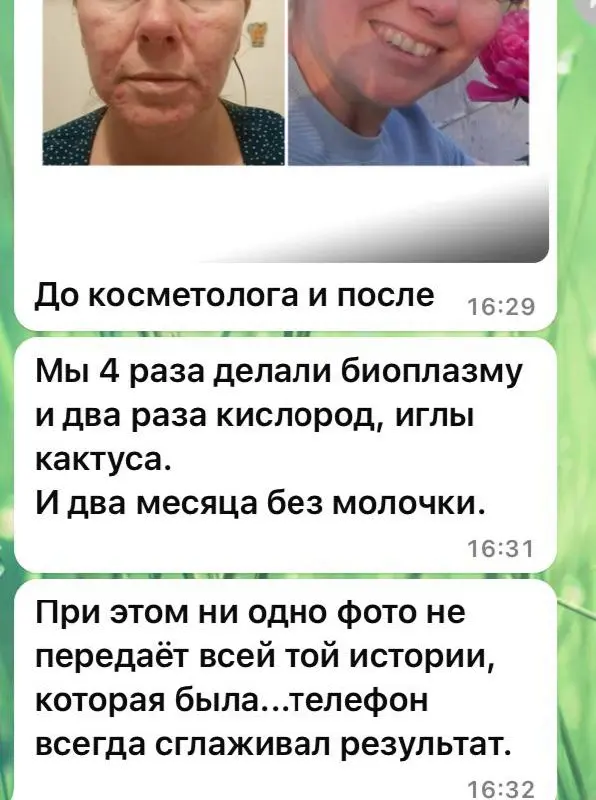 Отзывы о процедуре «Bioplasma» | Сетка — социальная сеть от hh.ru