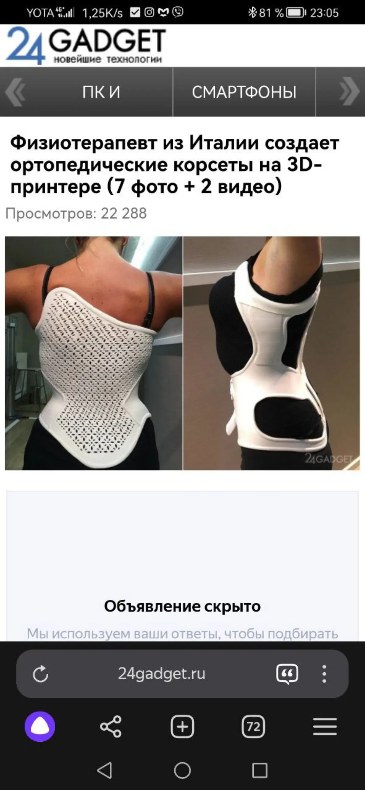 Про корсеты на 3D принтере | Сетка — социальная сеть от hh.ru