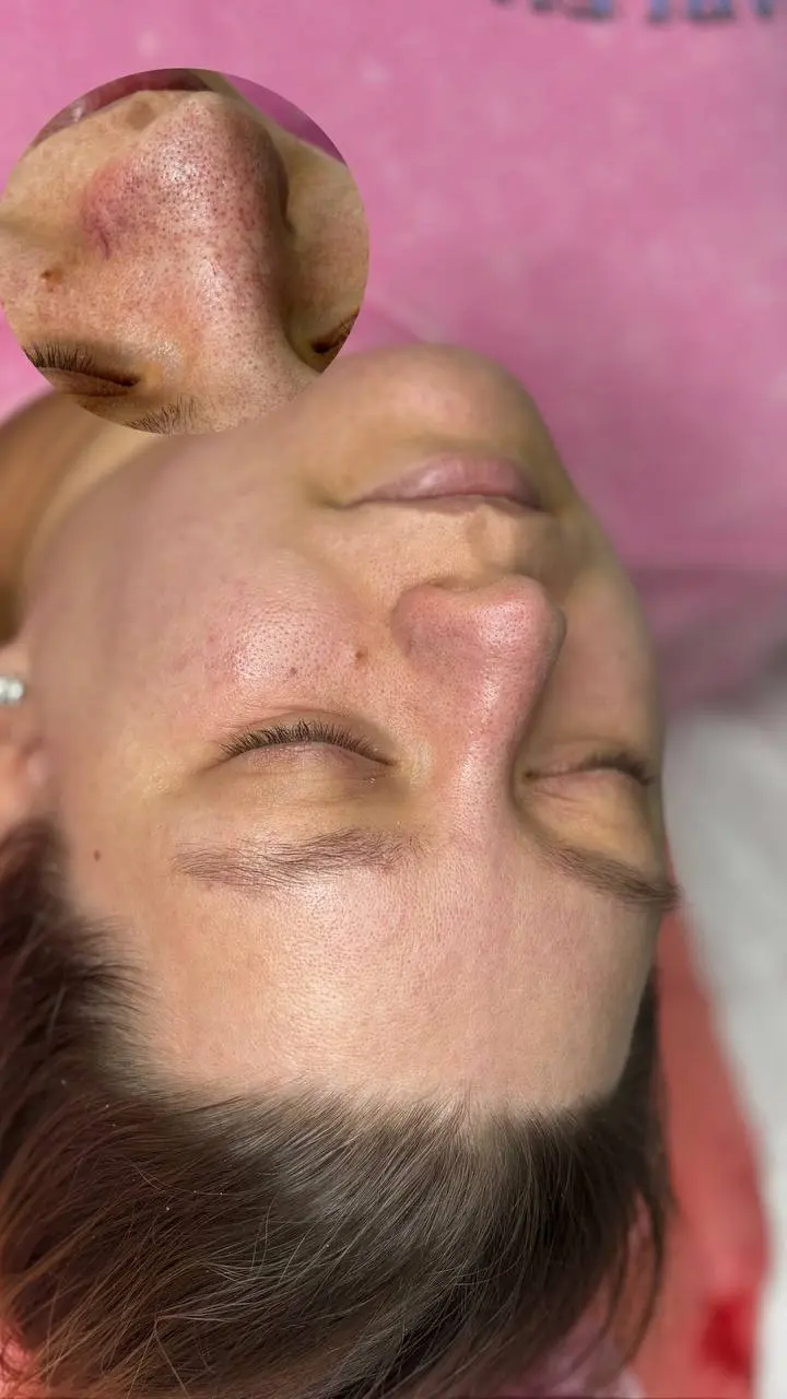 Комплексный уход за кожей✨
Осталось мало мест на март 🤭 | Сетка — социальная сеть от hh.ru