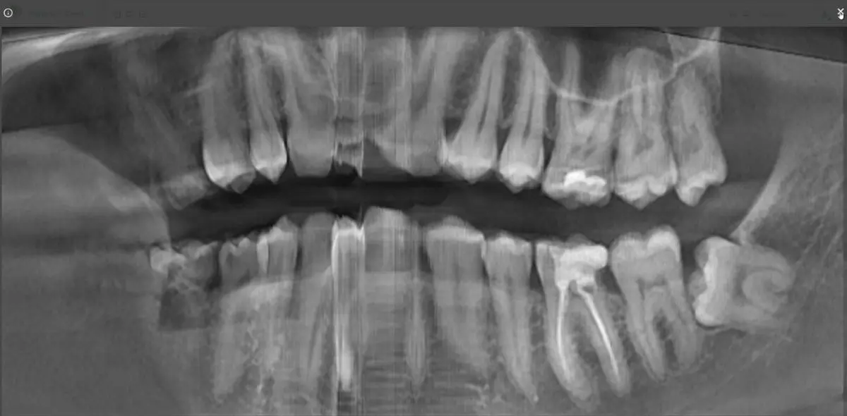 🦷 Future IT Dent + Dentomo: теперь диагностика и план лечен | Сетка — социальная сеть от hh.ru
