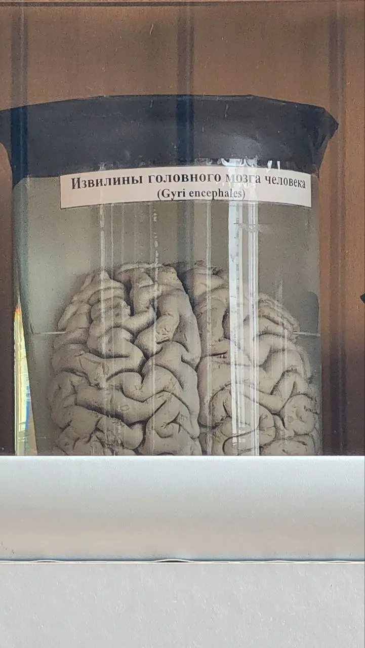 Анатомический музей УлГПУ: самое жуткое и завораживающее место «Стачки 2026» #Стачка #Ульяновск | Сетка — социальная сеть от hh.ru