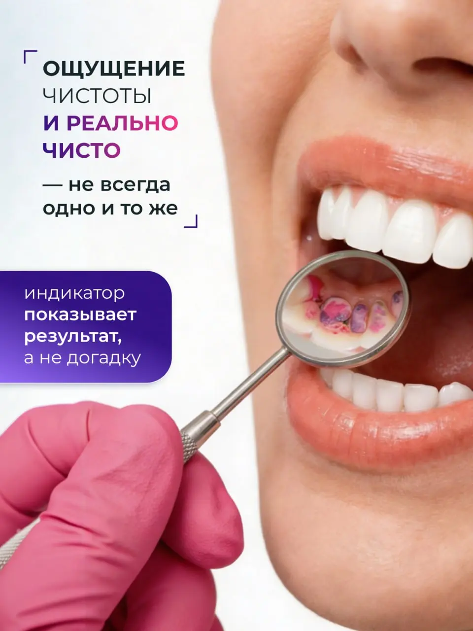 Как мы шутили над зубным налётом 1 апреля (и зачем это вообще нужно) 🦷😂
Знаете, что общего между первоапрельскими розыгрышами и индикатором зубного налёта? Правильно — и то и другое может неожиданно п... | Сетка — социальная сеть от hh.ru