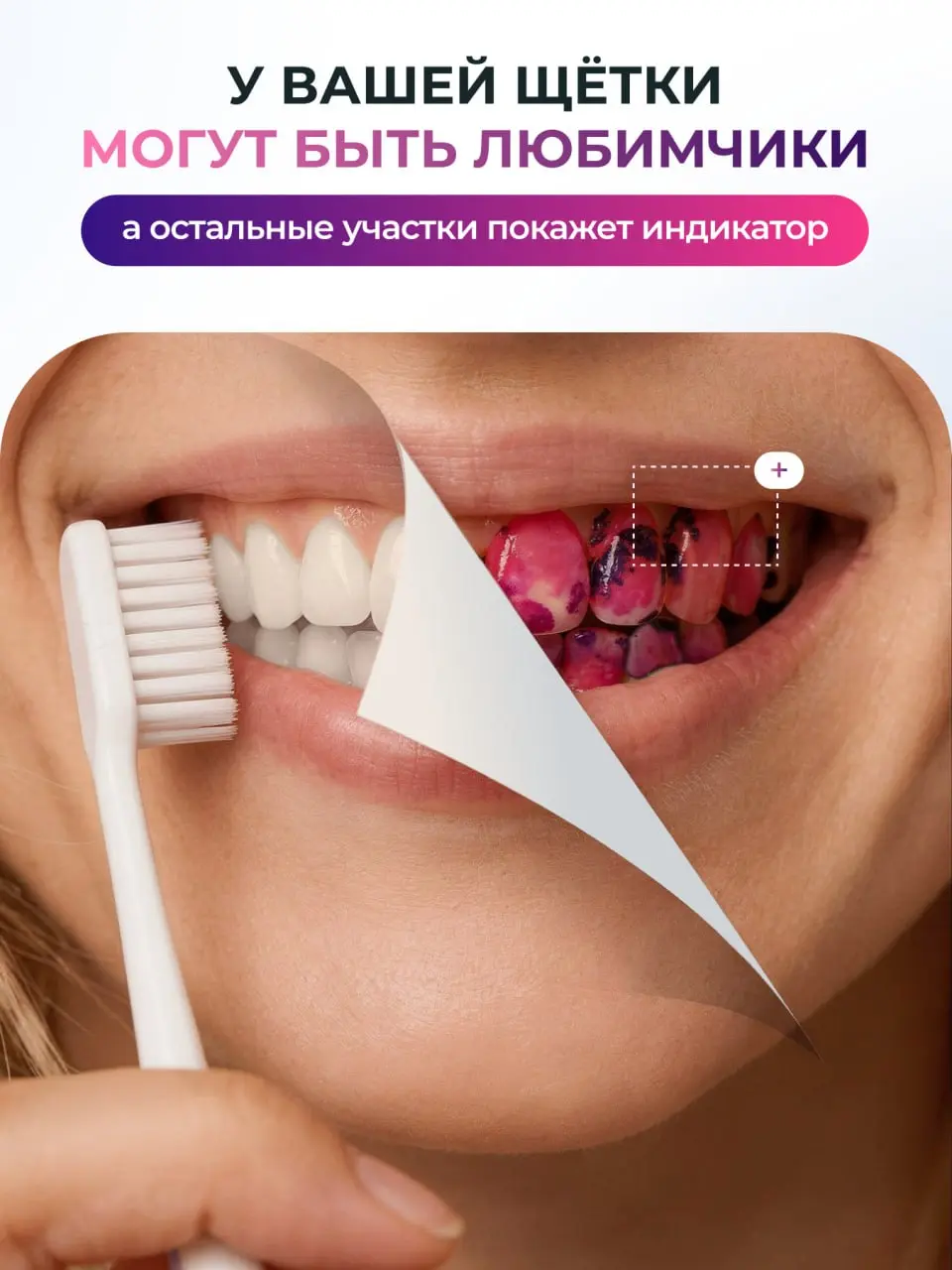 Как мы шутили над зубным налётом 1 апреля (и зачем это вообще нужно) 🦷😂
Знаете, что общего между первоапрельскими розыгрышами и индикатором зубного налёта? Правильно — и то и другое может неожиданно п... | Сетка — социальная сеть от hh.ru