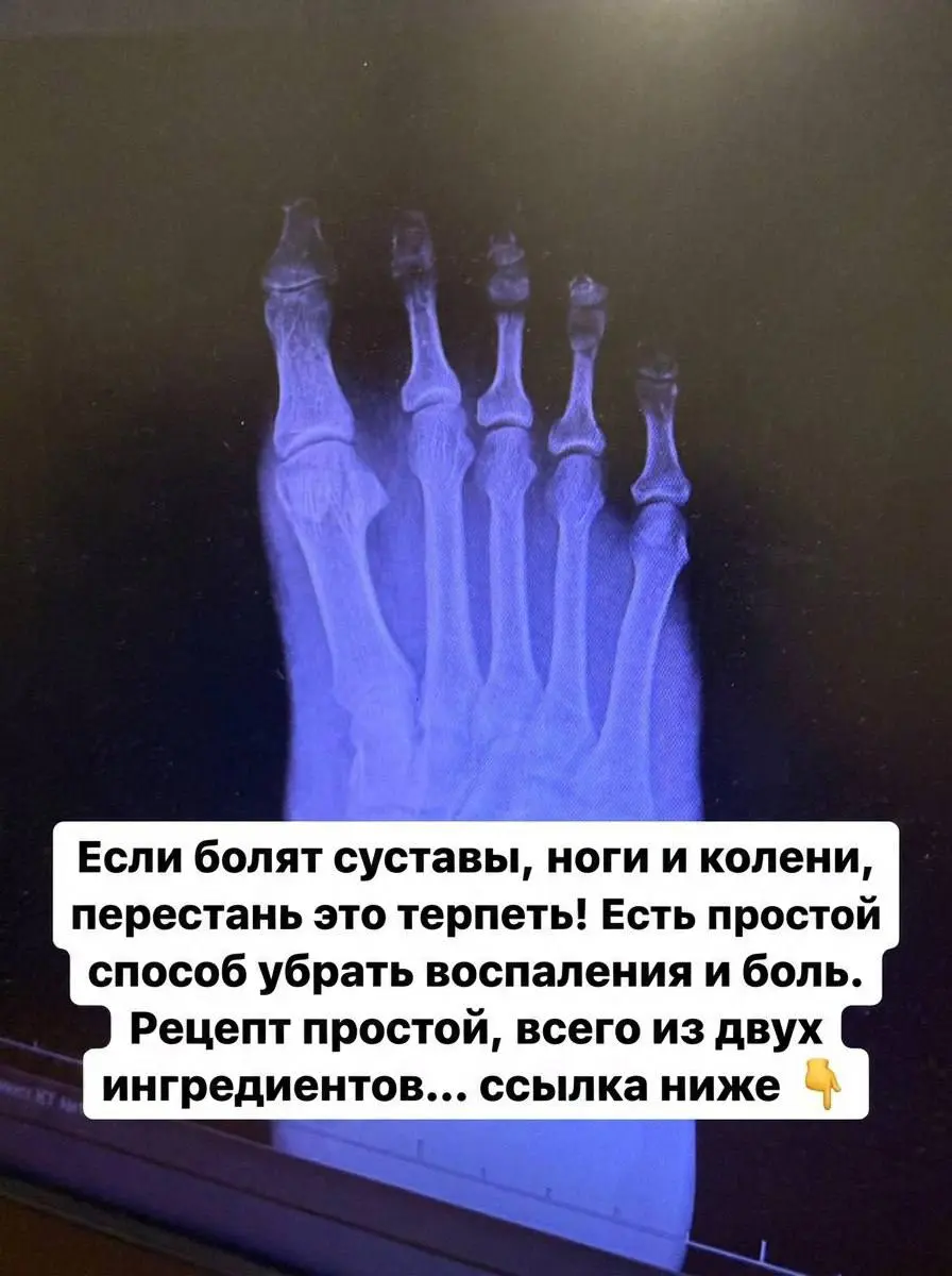 Простоя, но очень эффективная инструкция как сделать конвертящее крео | Сетка — социальная сеть от hh.ru