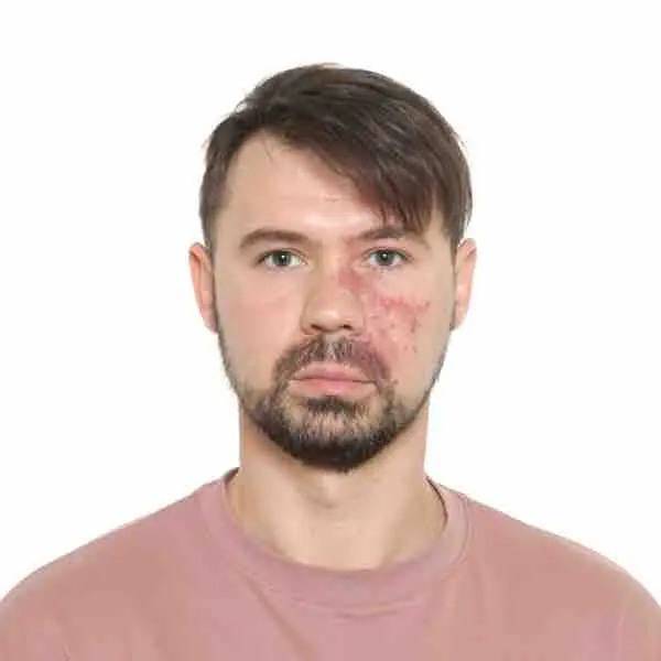 Денис Савченко