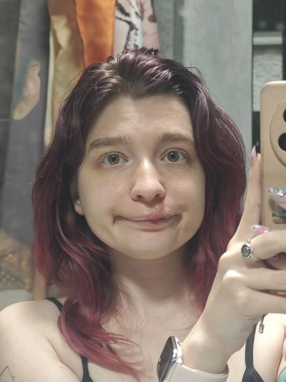 Апдейт губы
Весьма активно обрастает новой кожей и выравнивается даже
Уже спокойно двигаю её без особого дискомфорта, только внутренние уплотнения в этот момент ощущаются | Сетка — социальная сеть от hh.ru
