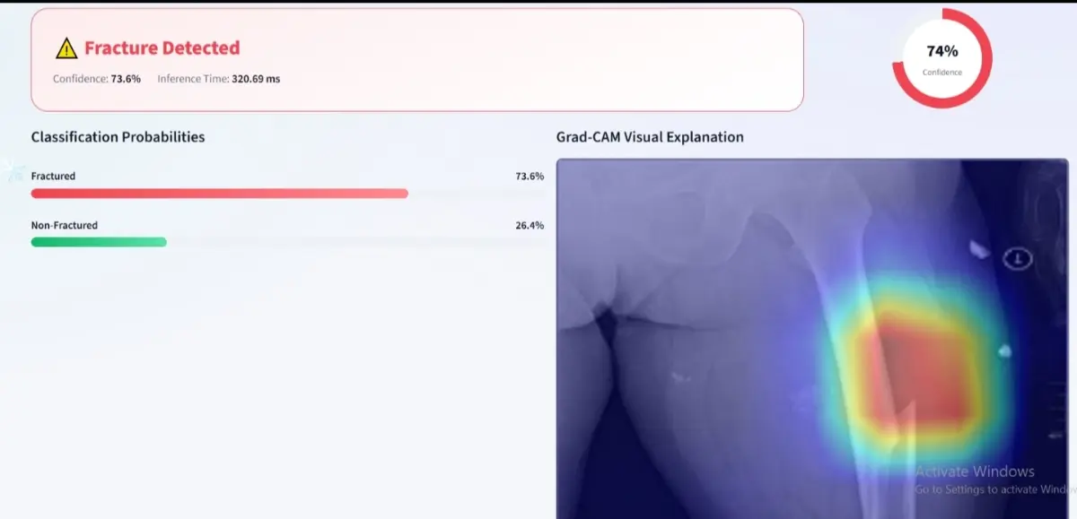 Как я превратил модель в
АІ-продукт: Fracture Detection AI | Сетка — социальная сеть от hh.ru