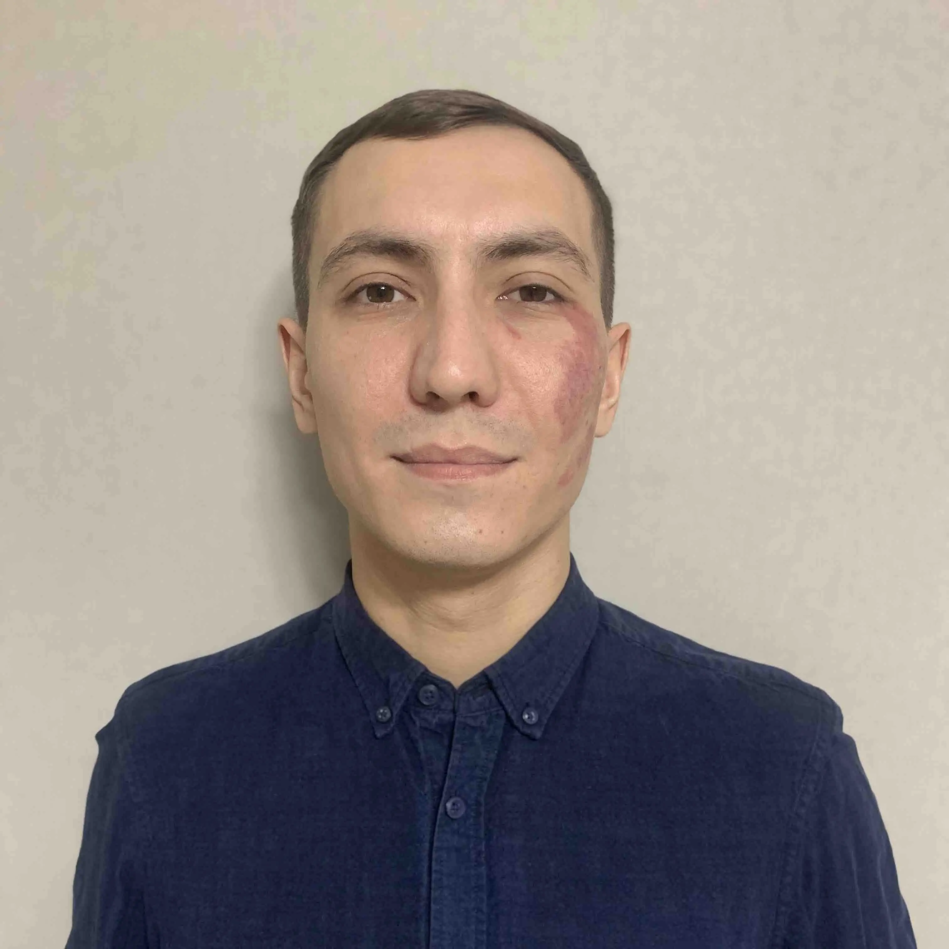 Ильдус Газетдинов