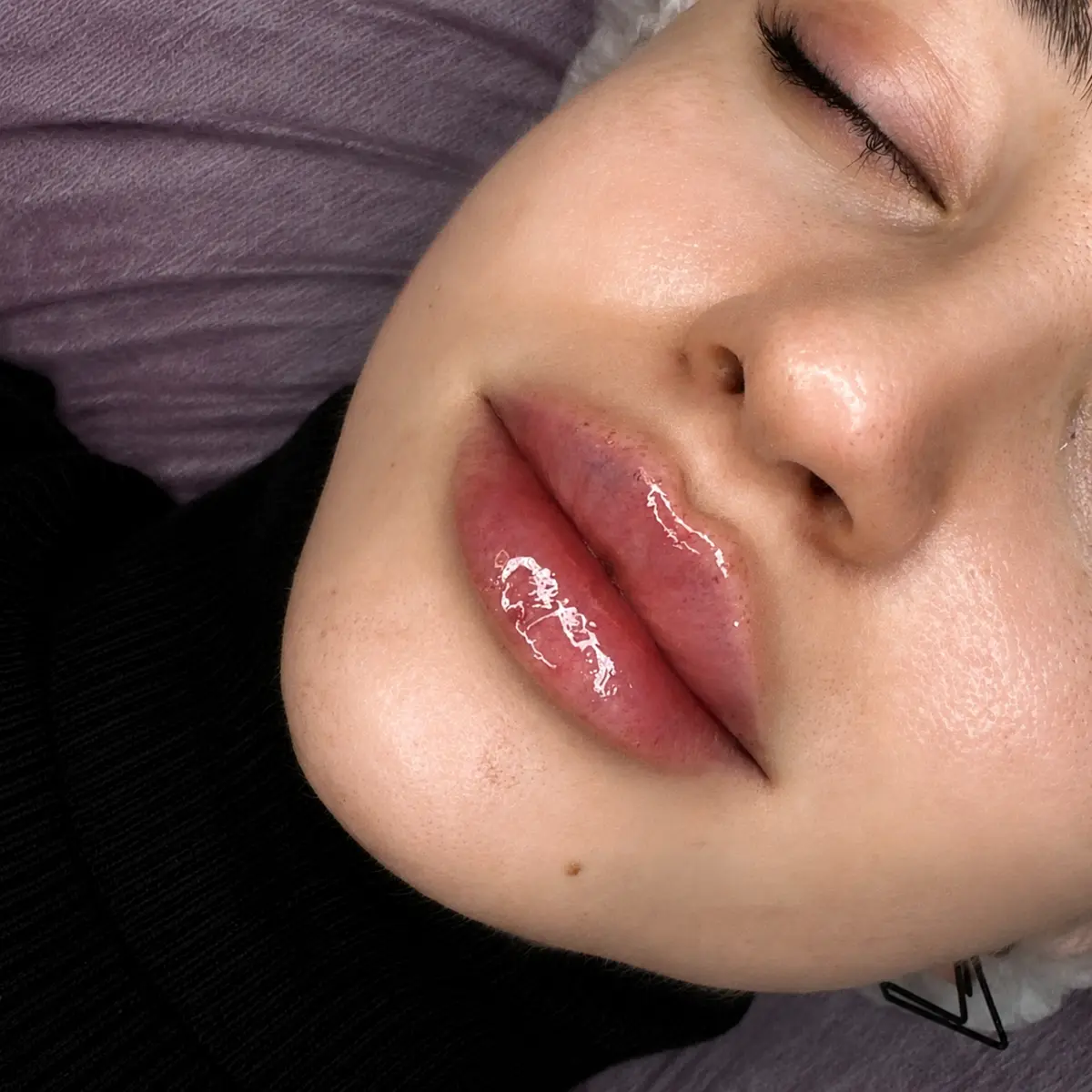 Контурная пластика губ 👄 | Сетка — социальная сеть от hh.ru