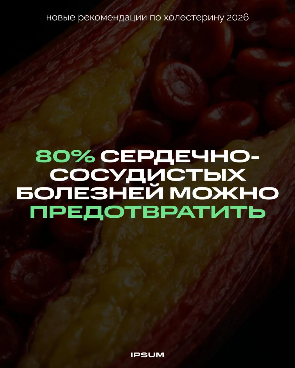 Вы знаете свой уровень Lp(a)? По новым рекомендациям, его стоит измерить хотя бы раз в жизни | Сетка — социальная сеть от hh.ru